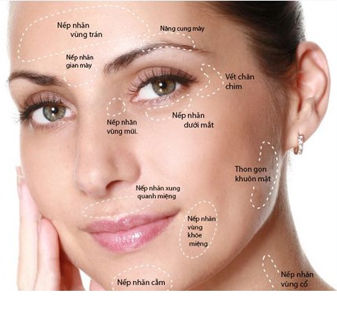 Căng da mặt không cần phẫu thuật với công nghệ HIFU